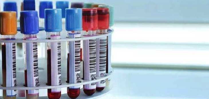 生殖管理中心提议抽血化验验HCG