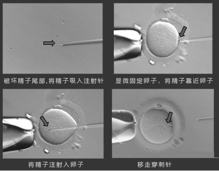 精子顶体酶低试管