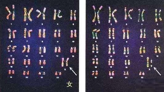 人体正常染色体分组图
