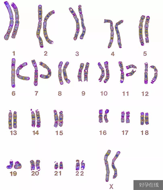 23对染色体