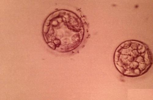 5天囊胚的着床过程会提前2-3天